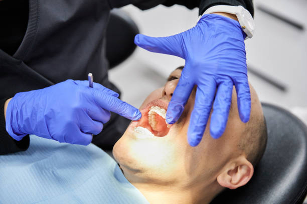 Best Emergency Root Canal Treatment in Newport, MN
